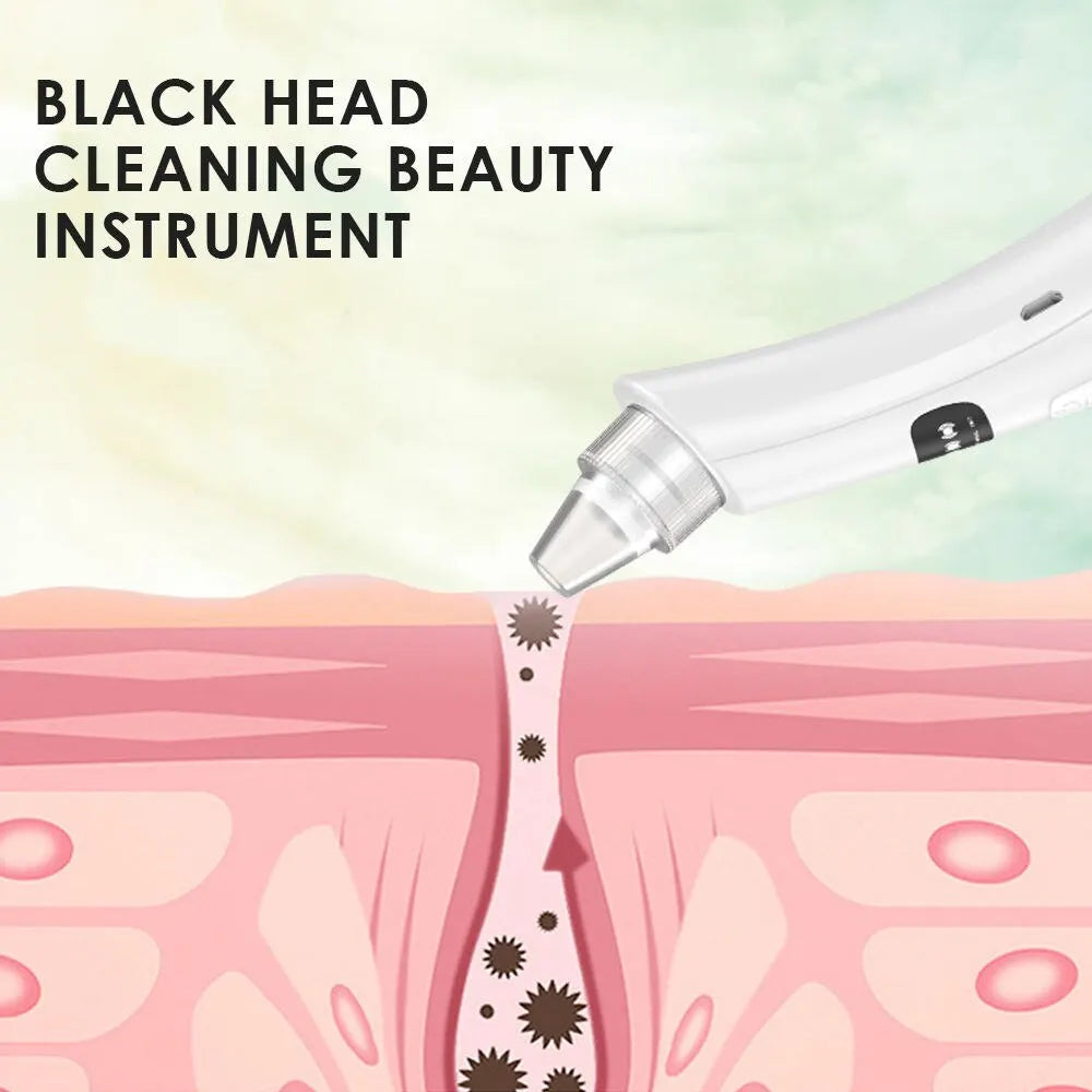 3-Mode Suction Face Cleansing Beauty Machine