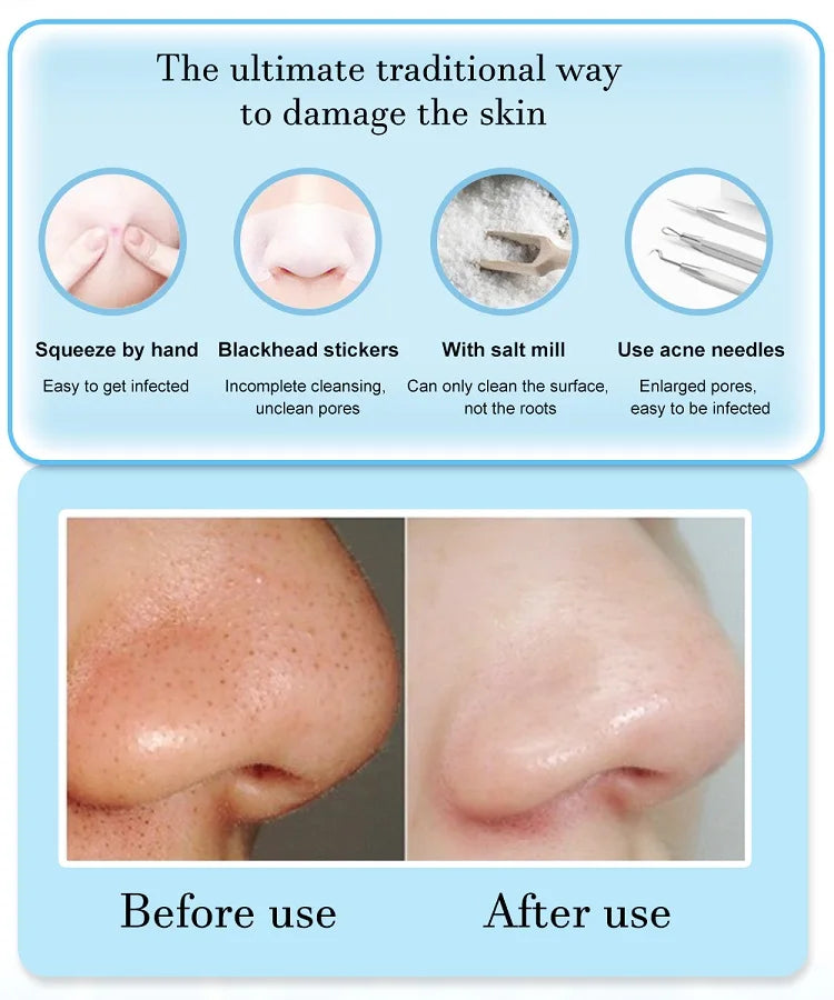 3-Mode Suction Face Cleansing Beauty Machine